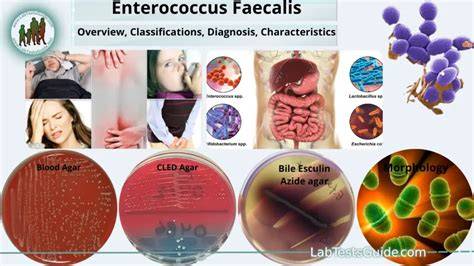 Infografic: Ramificațiile infecțiilor cu Enterococcus faecalis, trasee de transmitere, factori de risc și principalele opțiuni terapeutice