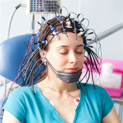 Imagine EEG (Electroencefalogramă)