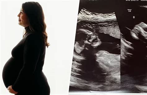 Femeie însărcinată radiind în natură