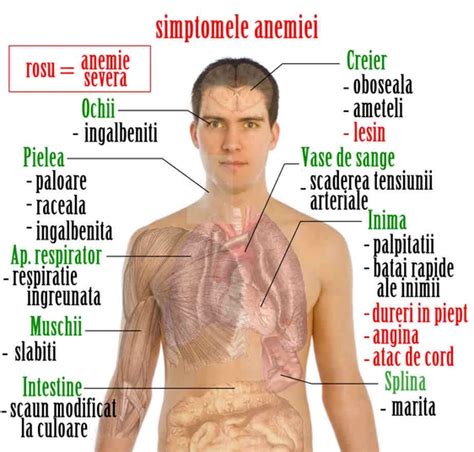 Schema: legătura dintre anemie, gură uscată și sete