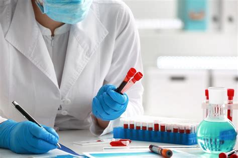 Diagrame: teste comune pentru setea excesivă și deshidratare
