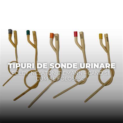 Infografic: Principalele tipuri de catetere urinare și utilizările lor