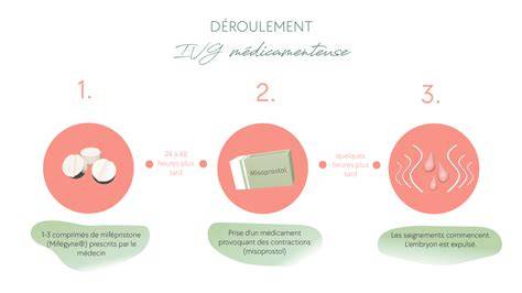 Grafica_durata_recuperare_avort_medicamenteux_vs_chirurgical
