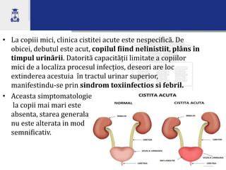 Infografic: Fluxul urinării normale la copii vs. polakiurie