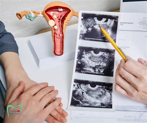 Sonda ecografică transvaginală