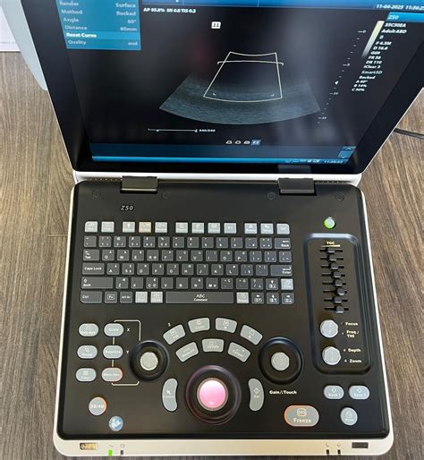 Vizualizare 3D a feței fetale