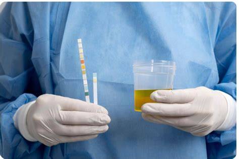 imagine test sarcină urine vs sânge