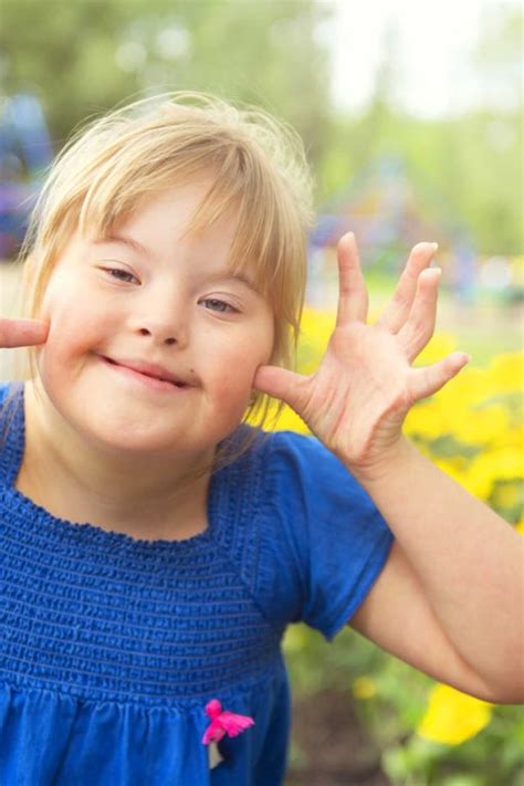 Echipa medicală implicată în îngrijirea unui copil cu sindrom Down