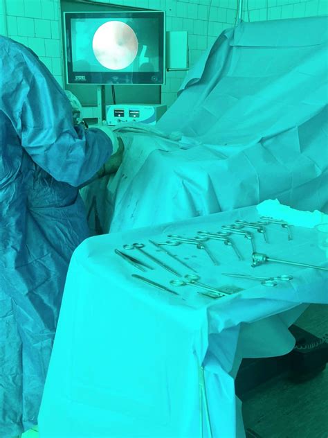 Echipament medical modern pentru chirurgie ginecologică