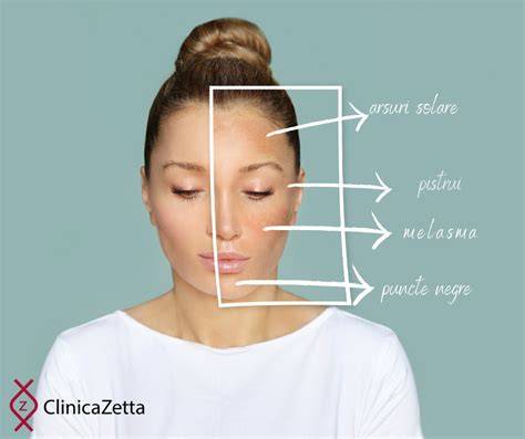 Infografic: Schimbari ale pielii in timpul sarcinii (melasma, vergeturi, PUPPP, acneea)