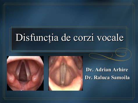 Infografic: mecanismele torsului pisicii (anatomie gât, os hioid, corzi vocale, vibrații)