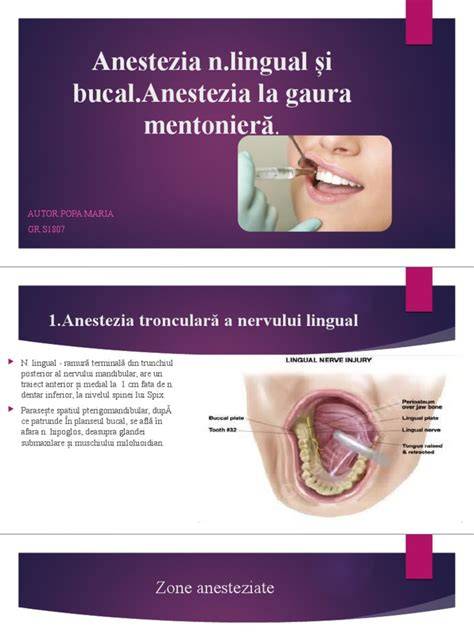 Infografic: anatomia frenului lingual și a planșeului bucal