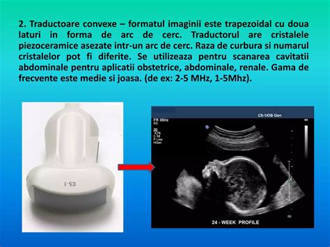Ultrasunete - ecografie morfologică trimestru II