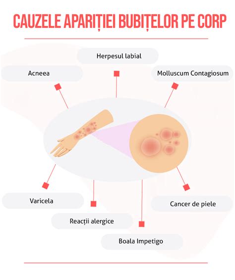 Infografic despre semnele și cauzele bubițelor pe corp