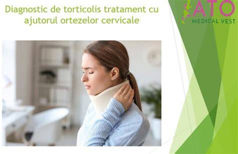Infografic: scheme de tratament torticolis