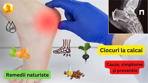 Diagnoza-amorteala-picior.jpg