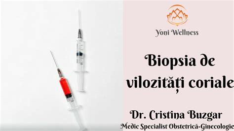 Infografie: traseul biopsiei de vilozități coriale
