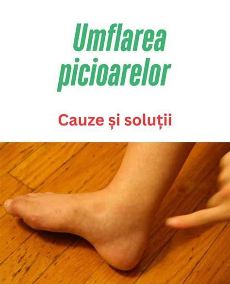 Infografic: Cauze și soluții pentru mirosul picioarelor la copii