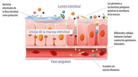 Schema interactionala gluten-glutens la nivel intestinal