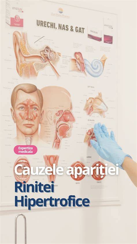 Infografic: Căi de cauzare ale nasului înfundat la copii