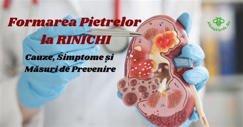 Infografic: „Cum ajută hidratarea la prevenția pietrelor la rinichi”