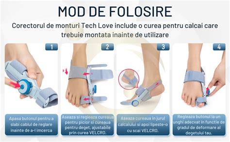 Infografic: etape si optiuni de tratament pentru talus valgus la bebelusi
