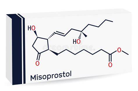 diagramă etapele avortului medicamentos (mifepristonă + misoprostol)