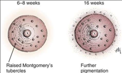 Fotografie cu tuberculi Montgomery la sân
