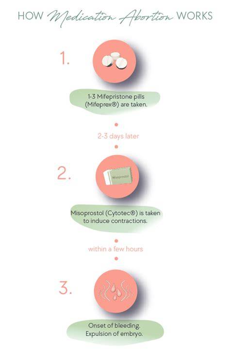 Diagrame: reacția uterină după administrarea misoprostolului