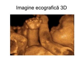 Imagine ecografică 3D a feței unui făt