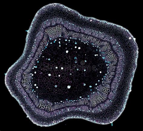 Reprezentare microscopică a anticorpilor antifosfolipidici