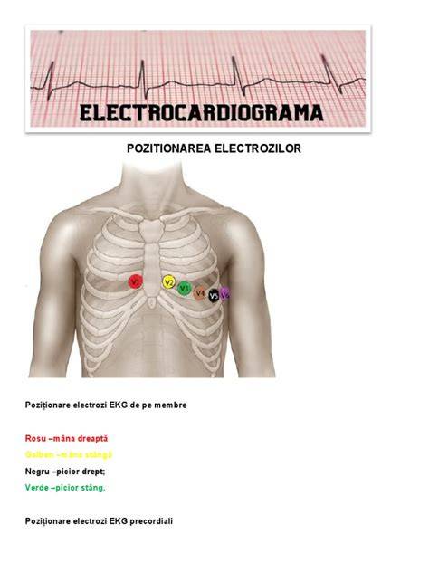Diagramă schematizată a poziționării electrozilor EKG pe torace