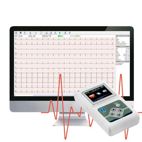 Grafice comparative: Holter EKG vs monitorizare telemetrică