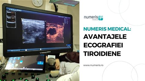 Ilustrație a ecografiei tiroidiene
