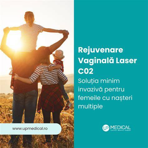 Infografice despre procesul de rejuvenare vaginala cu laser CO2