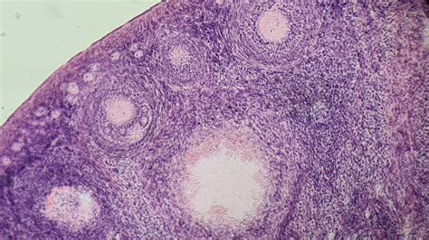 Foliculi ovarieni în curs de dezvoltare