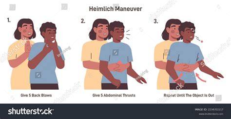 Schema manevrelor Heimlich adaptate vârstei