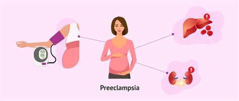 Preeclampsia - infografic: semne, simptome și screening