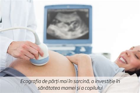 Infografic despre sănătatea în sarcină