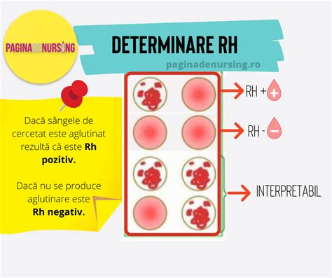 Reprezentare vizuală a grupelor sanguine cu Rh pozitiv și negativ