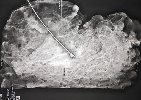 Ilustrație pas cu pas a tehnicii de schimbare a scutecului