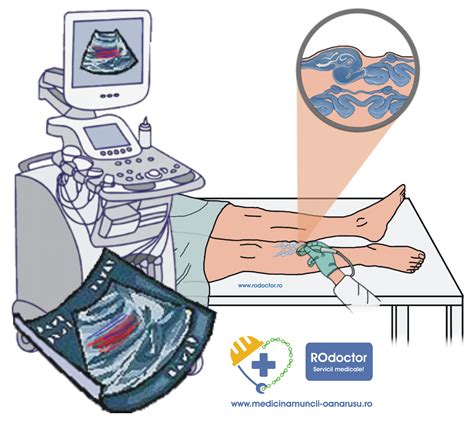 Ecografie Doppler fetală - visualizarea ductului venos și venei ombilicale