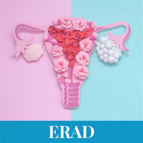 Diagramă ERAD în ginecologie