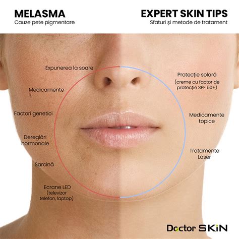 Diagramă a etapei: peeling depigmentant vs. laser vs. mezoterapie pentru melasma