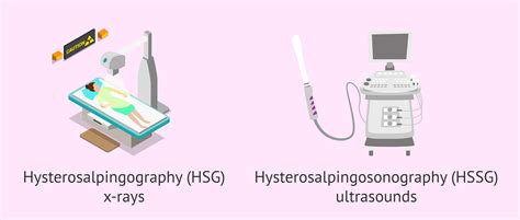 Imagine: HyFoSy vs. HSG