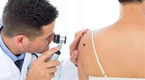 Copil expus la soare