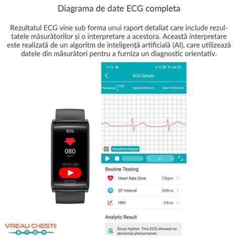 Infografic: flux de lucru optim pentru monitorizarea vitale