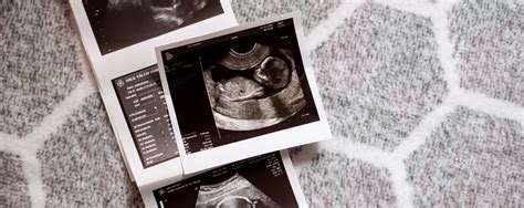 Ecografie morfologică trimestrul 2