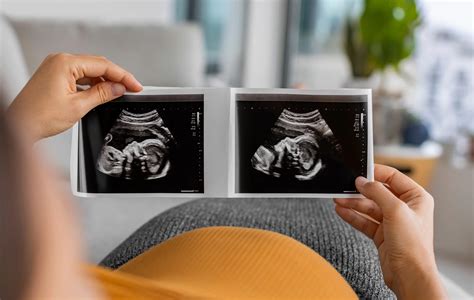 Etape ecografii sarcina