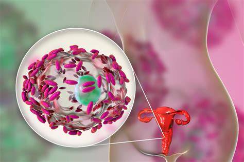 Infografic: factori ce afectează flora vaginală și măsuri de susținere